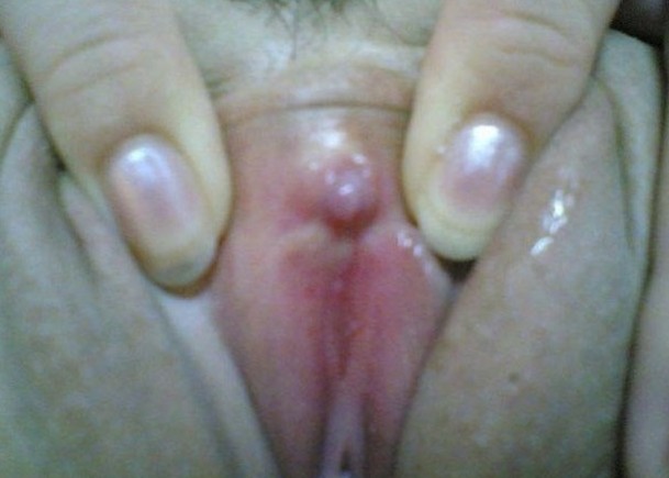 Indon Teen Clit